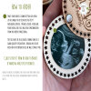 Fathers day from the bump, baby ultrasound fridge magnet, First fathers day gift, 1st fathers day, fathers day gift from wife,love from bump