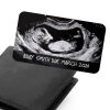 Pregnancy Announcement Baby Scan Metal Wallet Photo Card Insert ,Sonogram Gift - New Daddy Gift - Pregnancy Scan Keepsake, Baby Scan Gift. - Single Wallet Card